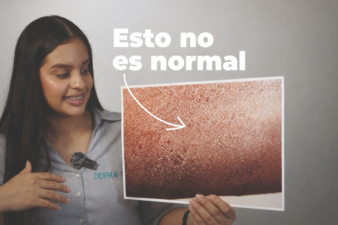 sequedad en la piel: señales, causas y cómo tratarla