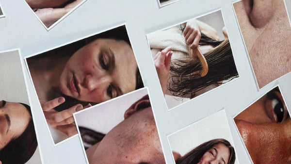 Poros abiertos: guía sencilla para reducir su apariencia