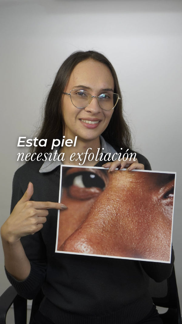 ¿Tu piel se ve apagada o con textura? Tu piel necesita exfoliación